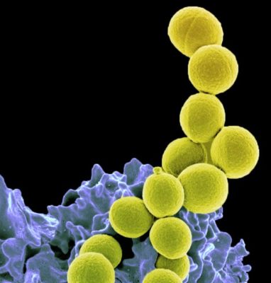 Methicillin-resistant S. aureus (MRSA - yellow) being ingested by neutrophil (purplish blue). Image credit: NIAID (Wikimedia Commons)