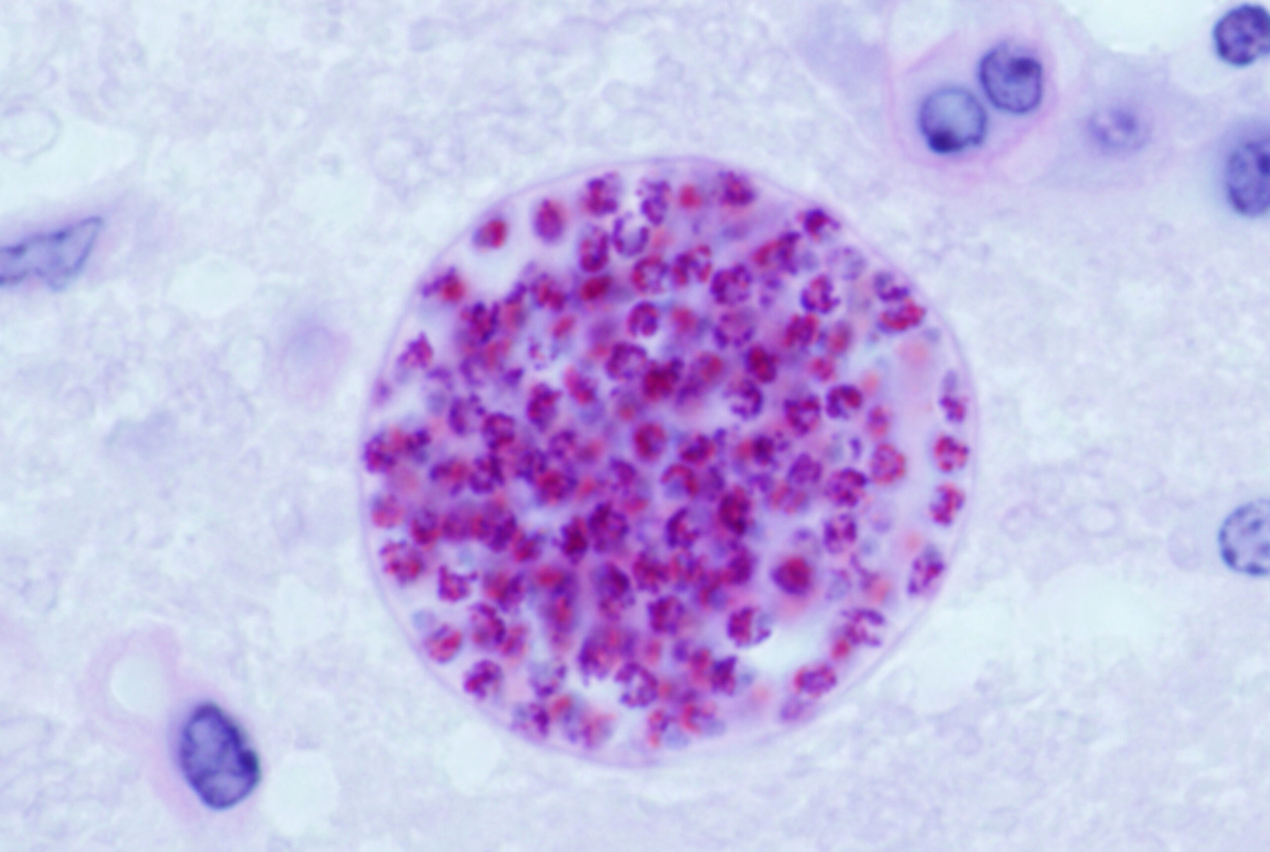 Toxoplasma gondii tissue cyst in a mouse brain.